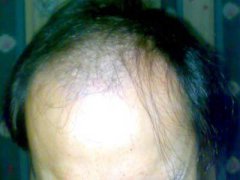 Ó�l(f��)�İY��