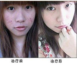 �L(zh��ng)��Ƥ�w���t(y��)Ժ�t(y��)����B�ഺ��