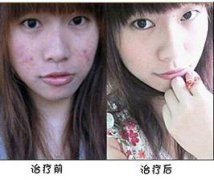 長春膚康醫(yī)院