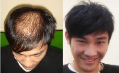 �L���ί�Ó�l(f��)