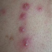 ë���׵ı��F(xi��n)�Y��