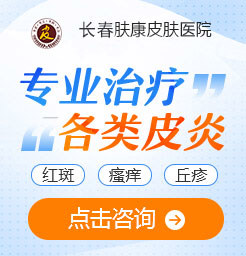 �L��Ƥ�w�t(y��)Ժ��ԃ�^����Ƥ�ו�������ȫ���